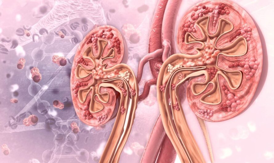 Kidney Cancer Drugs Market is Estimated to Witness High Growth Owing to Increasing Prevalence of the Disease and Advancements in Treatment Options