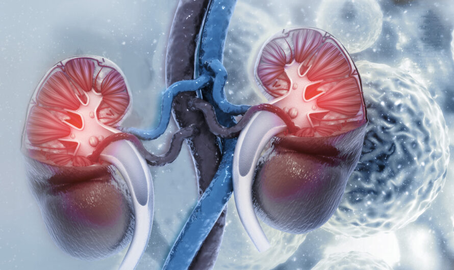 Development of Innovative Drugs is Projected to Boost the Growth of Kidney Cancer Drugs Market