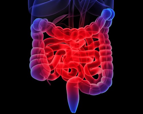 Doctors Discover High Prevalence of Malnutrition in Patients with Inflammatory Bowel Disease