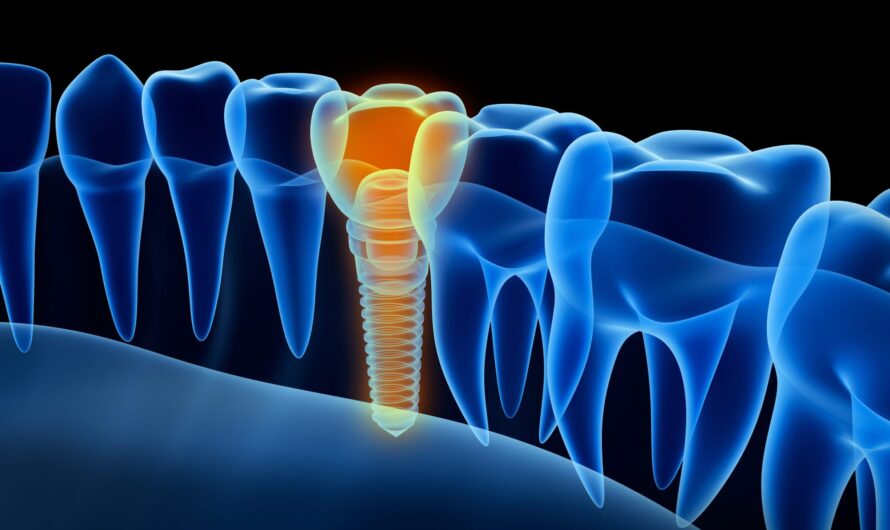 Dental Turbine Market Is Expected To Be Flourished By Growing Demand For Cosmetic Dentistry Treatments