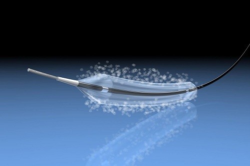 The Global Drug Eluting Balloon Market Is Driven By Rising Incidence Of Cardiovascular Diseases