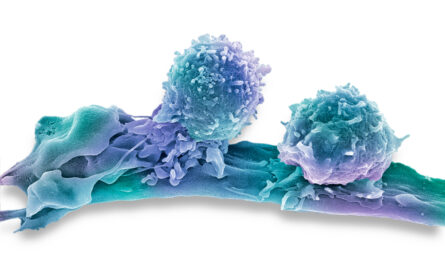 Immune Cell to Combat Cancer