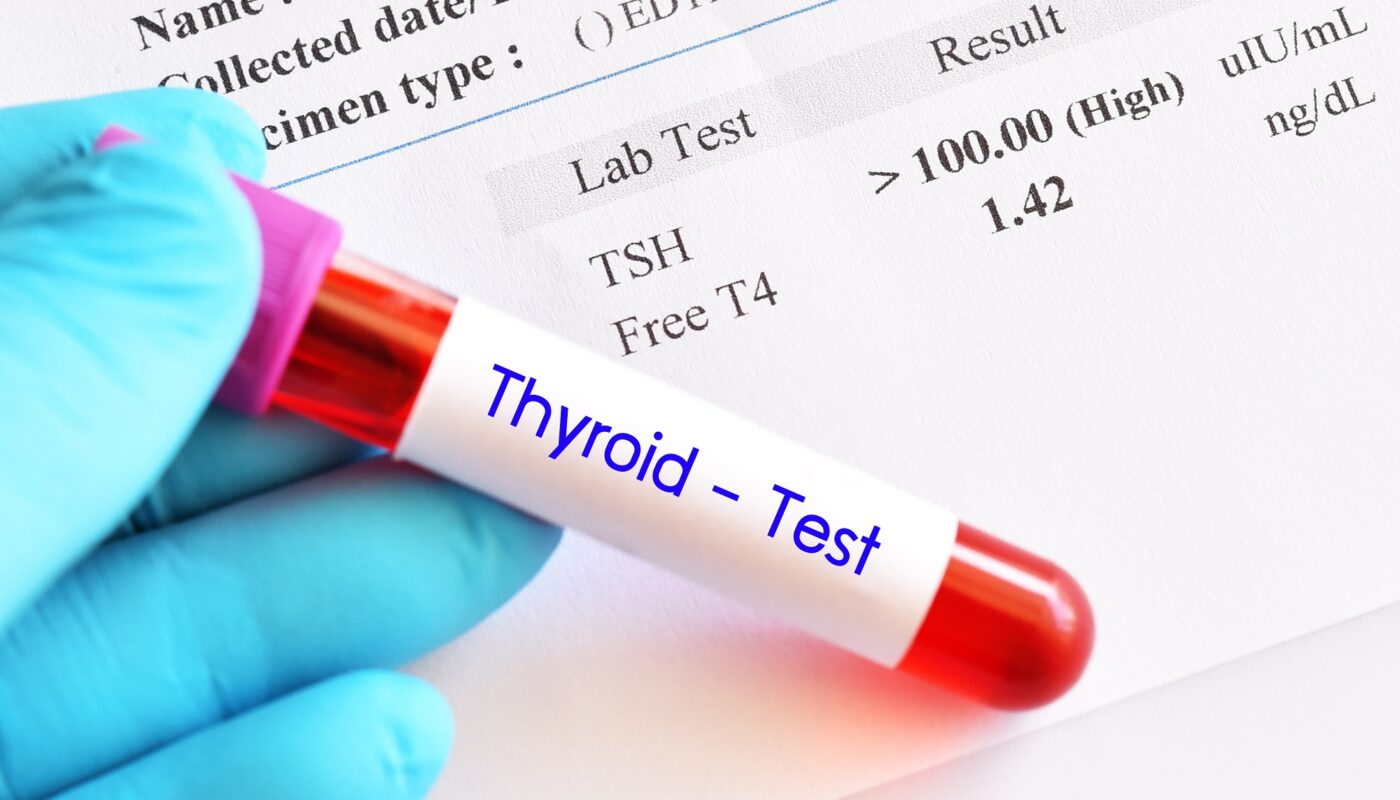 India Thyroid Function Test Market