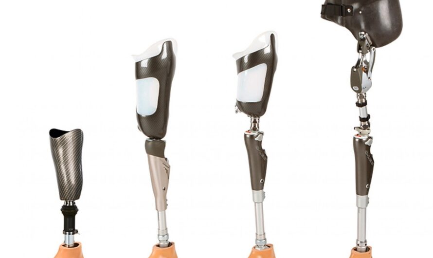 The Orthopedic Prosthetic Market Is Expected To Be Flourished By Rising Geriatric Population