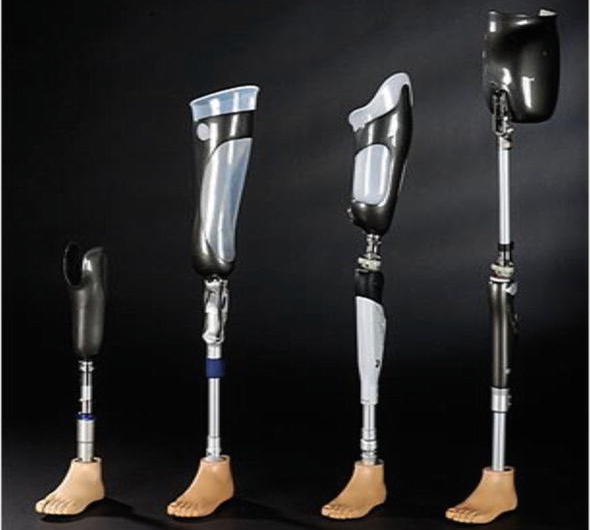 The Global Prosthetics and Orthotics Market is Driven by Increasing Cases of Accidents and Trauma