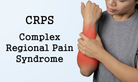 Global Complex Regional Pain Syndrome Market