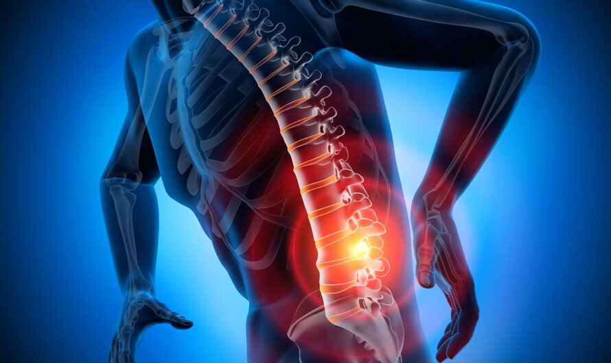 Interventional Pain Management Market Is Estimated To Witness High Growth Owing To Increase In Cases Of Chronic Pain
