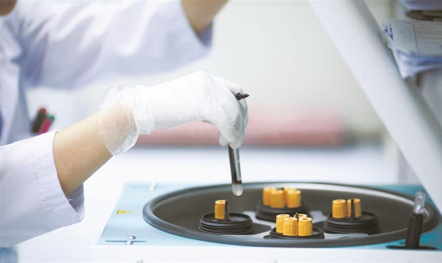 Mexico In-Vitro Diagnostics Market is Estimated to Witness High Growth Owing to Advancements in Automated Diagnostic Technologies