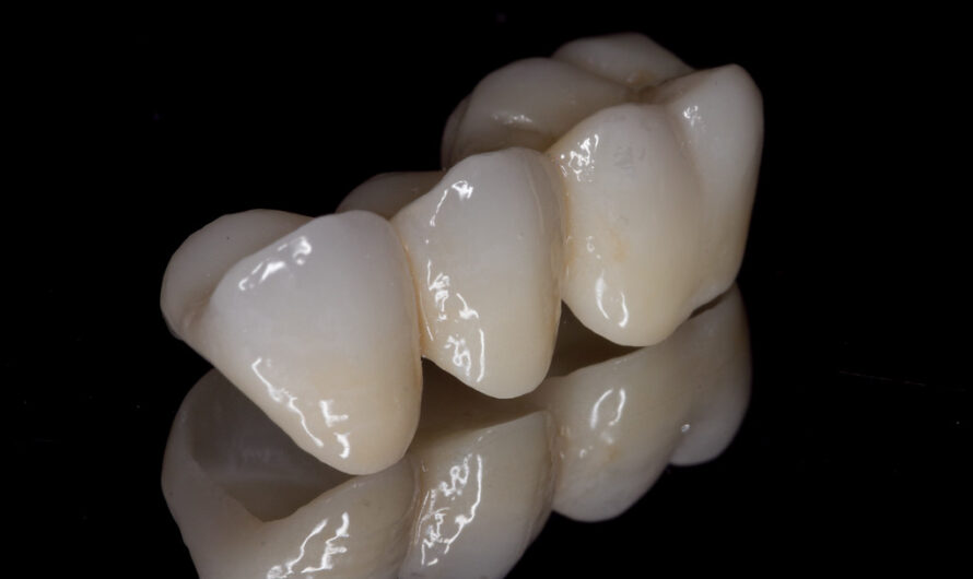 Zirconia Based Dental Materials Market is gaining momentum owing to technological advancements