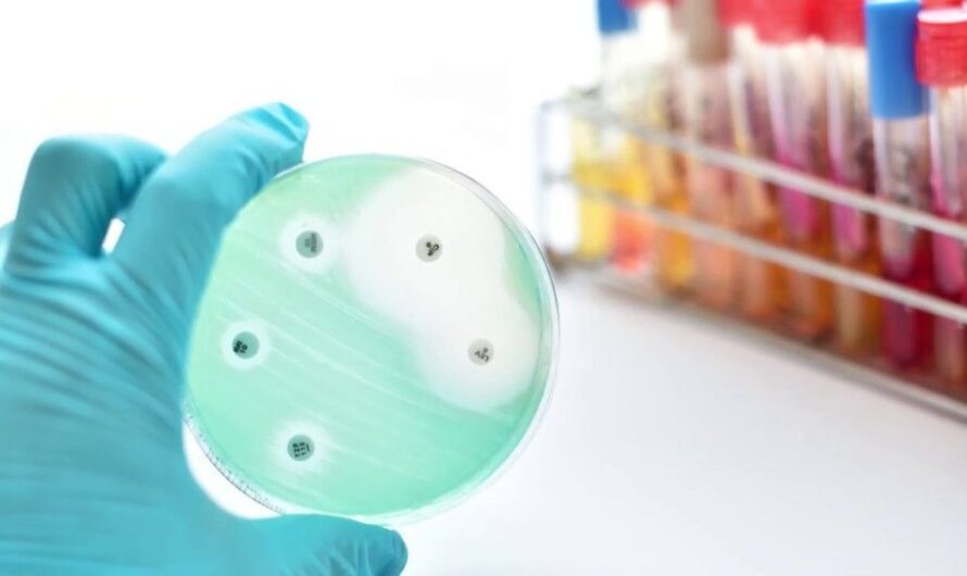 Understanding Antimicrobial Susceptibility Testing Antibiotics Have Revolutionized Healthcare