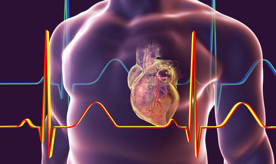 Cardiology Electrodes: Understanding Their Types and Uses in Diagnosis