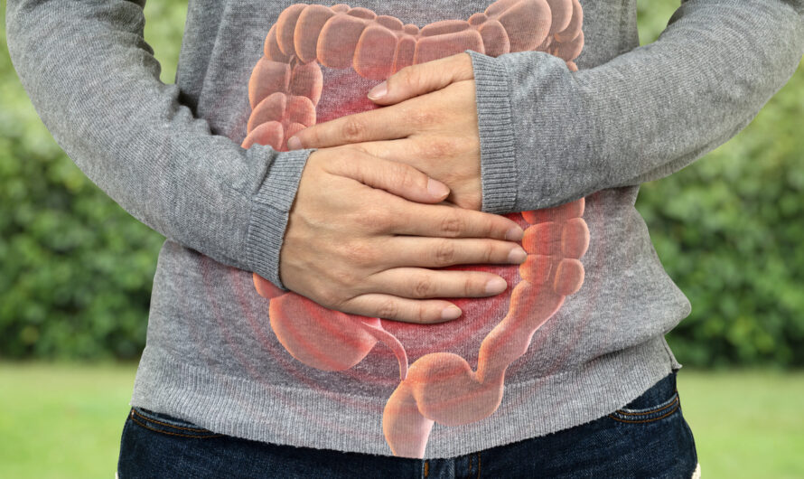 Comprehensive Overview of Inflammatory Bowel Disease Understanding Crohn’s Disease and Ulcerative Colitis