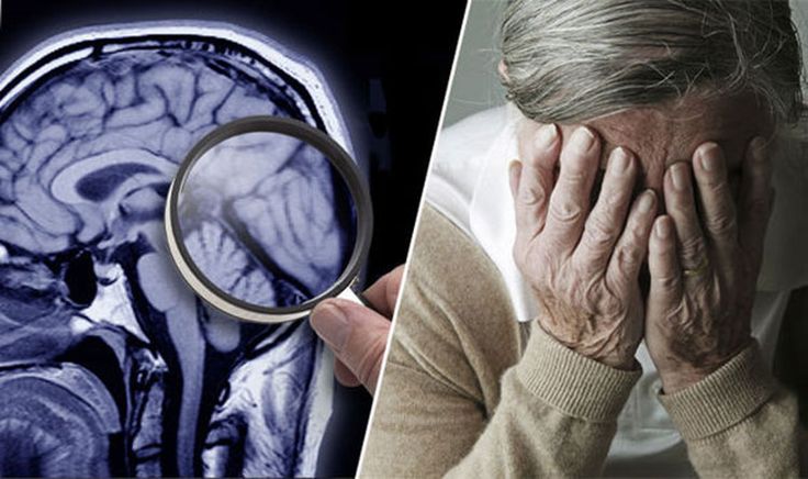 Revolutionary Test Identifies Early Signs of Dementia Up to Nine Years Before Diagnosis