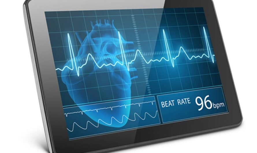 Mobile ECG Devices Industry: ECG Devices Shaping the Future of Cardiac Monitoring through Advanced Technologies