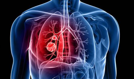Respiratory Tract Infection Treatment