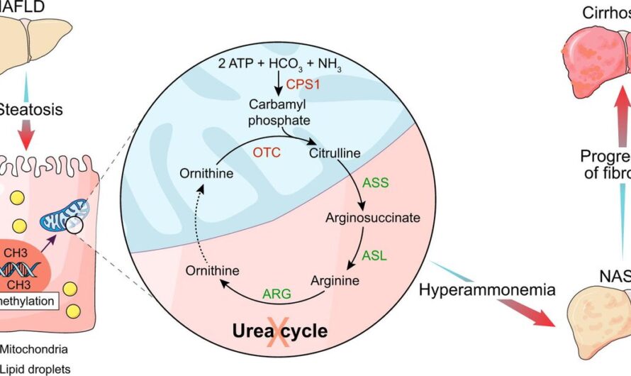 U.S. Urea Cycle Disorders Treatment Market set to Witness Growth Due to Advancements in Gene Therapy