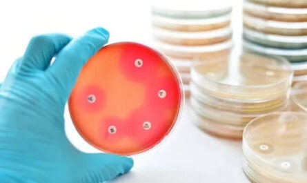 Antimicrobial Susceptibility Testing