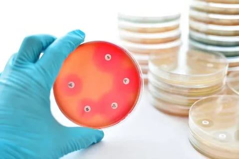 Antimicrobial Susceptibility Testing Effective Methods to Determine Resistance and Guide Treatment Decisions