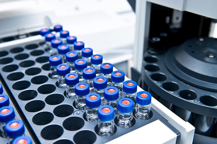 Liquid Chromatography Mass Spectrometry (LCMS) Market Paving the Way for Advanced Healthcare Diagnostics