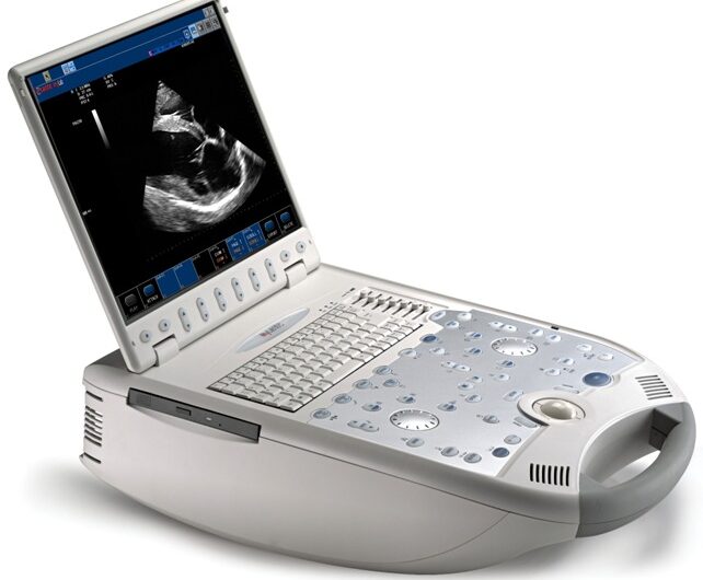 Portable Ultrasound Bladder Scanner Market is Estimated to Witness High Growth Owing to Advancements in Portability and Ease of Use